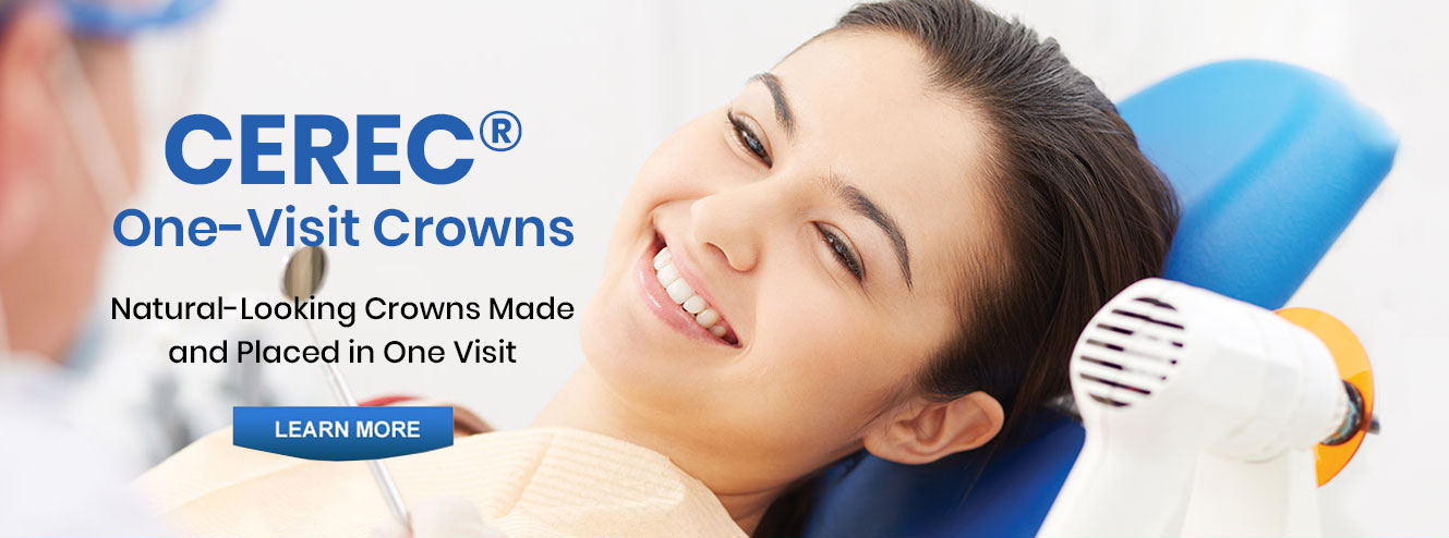 Cerec One Visit
